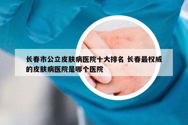 长春青春痘医院